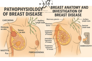 Breast cancer Pathophysiology